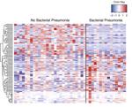 Multidimensional assessment of the host response in mechanically ventilated patients with suspected pneumonia